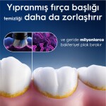 Oral-B iO Gentle Care Beyaz Diş Fırçası Yedek Başlığı 4 Adet Yumuşak Kıllarla Hassas Temizlik
